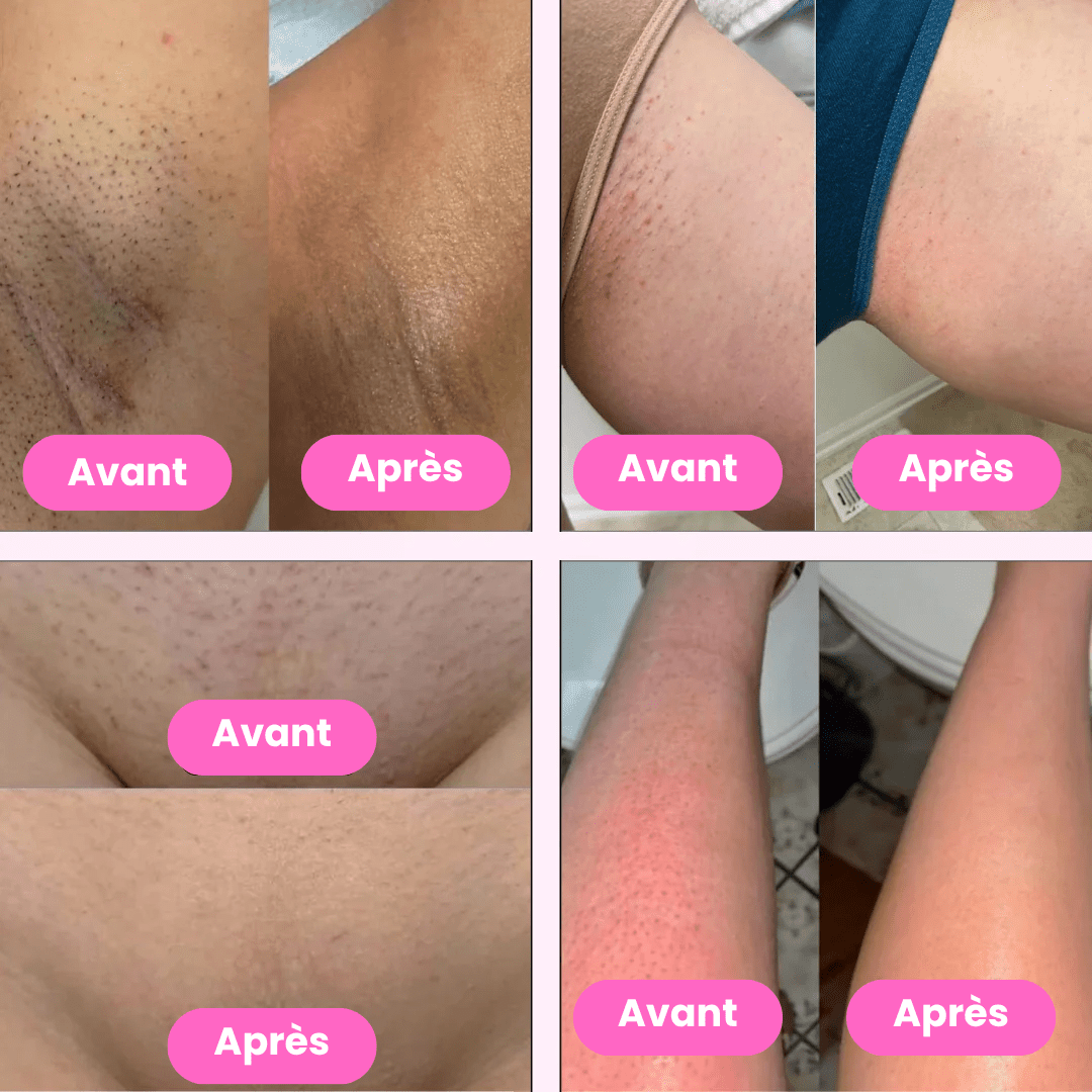 Lady Shaver • Épilateur Électrique - Lumérya Skin Atelier