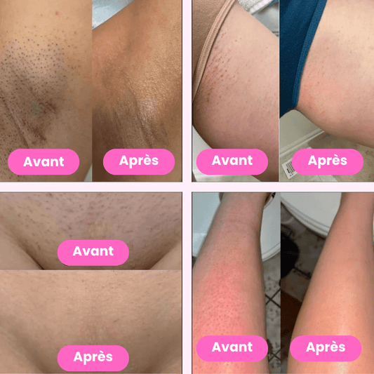 Lady Shaver • Épilateur Électrique - Lumérya Skin Atelier