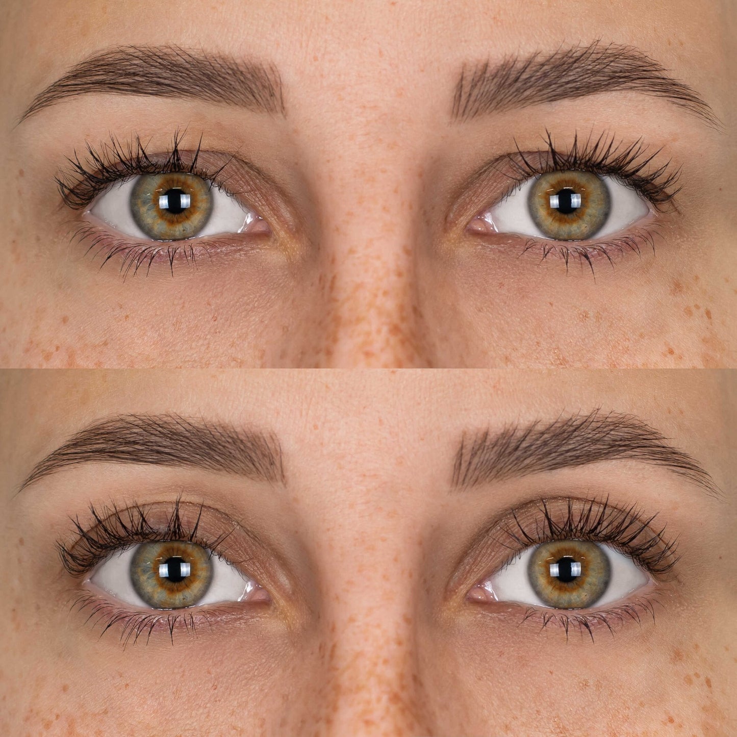 Patchs Lift Paupières - Lumérya Skin Atelier