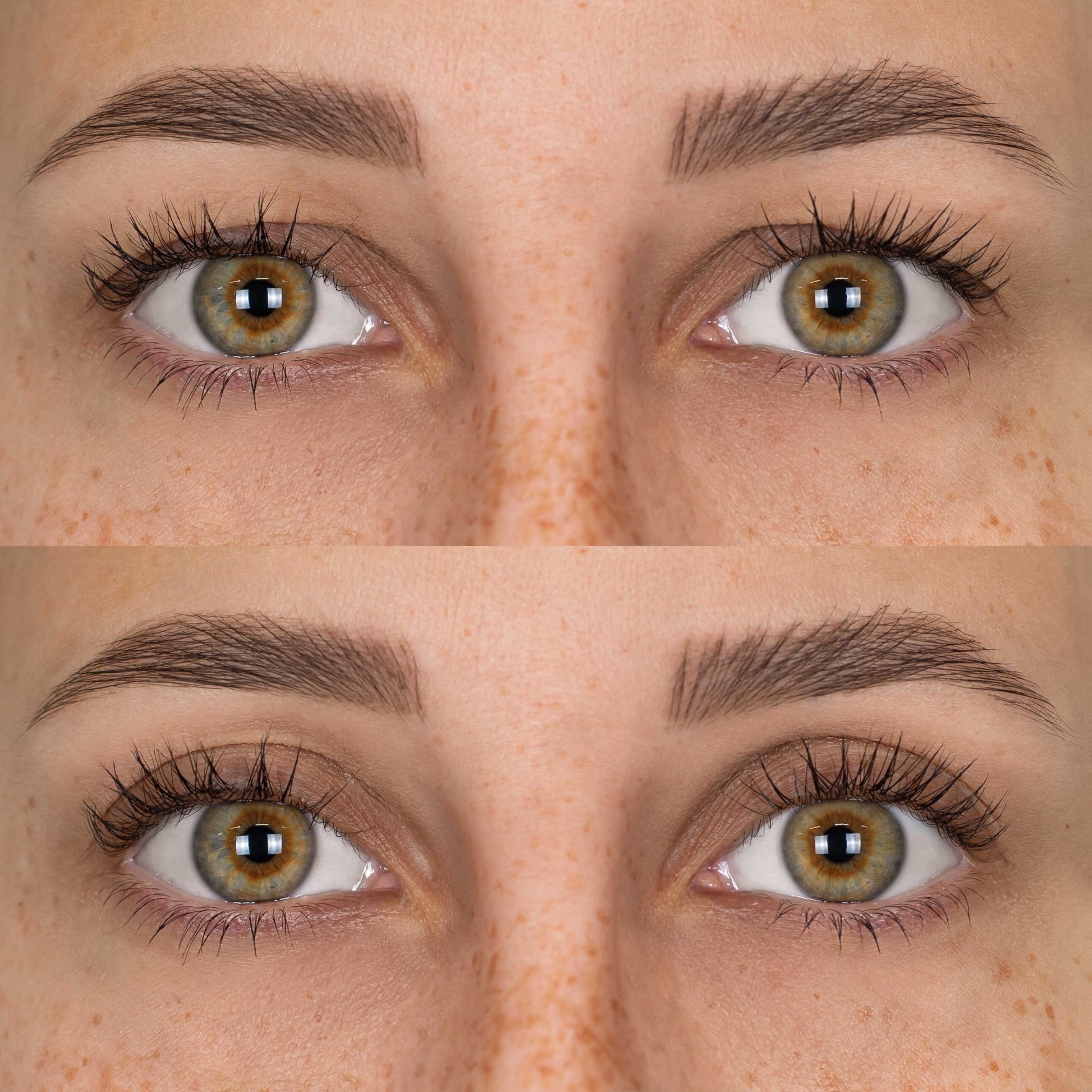 Patchs Lift Paupières - Lumérya Skin Atelier